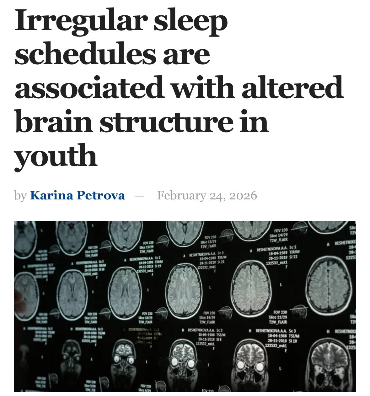 Збитий режим робить людину дурнішою-довели вчені