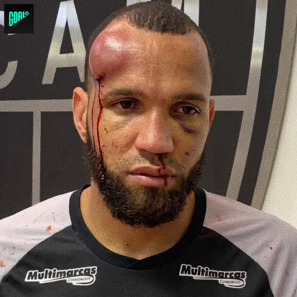 Справжня бійня! Суддя вилучив аж 23 гравців за один матч на фіналі бразильського чемпіонату штату Мінейро з футболу.